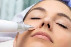 Best Actinic Keratoses Removal 3 Actinic keratoses Newcastle solutions - book in today!