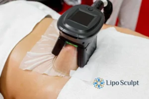 Does Fat Freezing At Home Work? 3 Fat freezing at home from Lipo Sculpt Newcastle